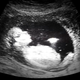 Illustration for article titled 7 Things Babies Learn While Still In The Womb